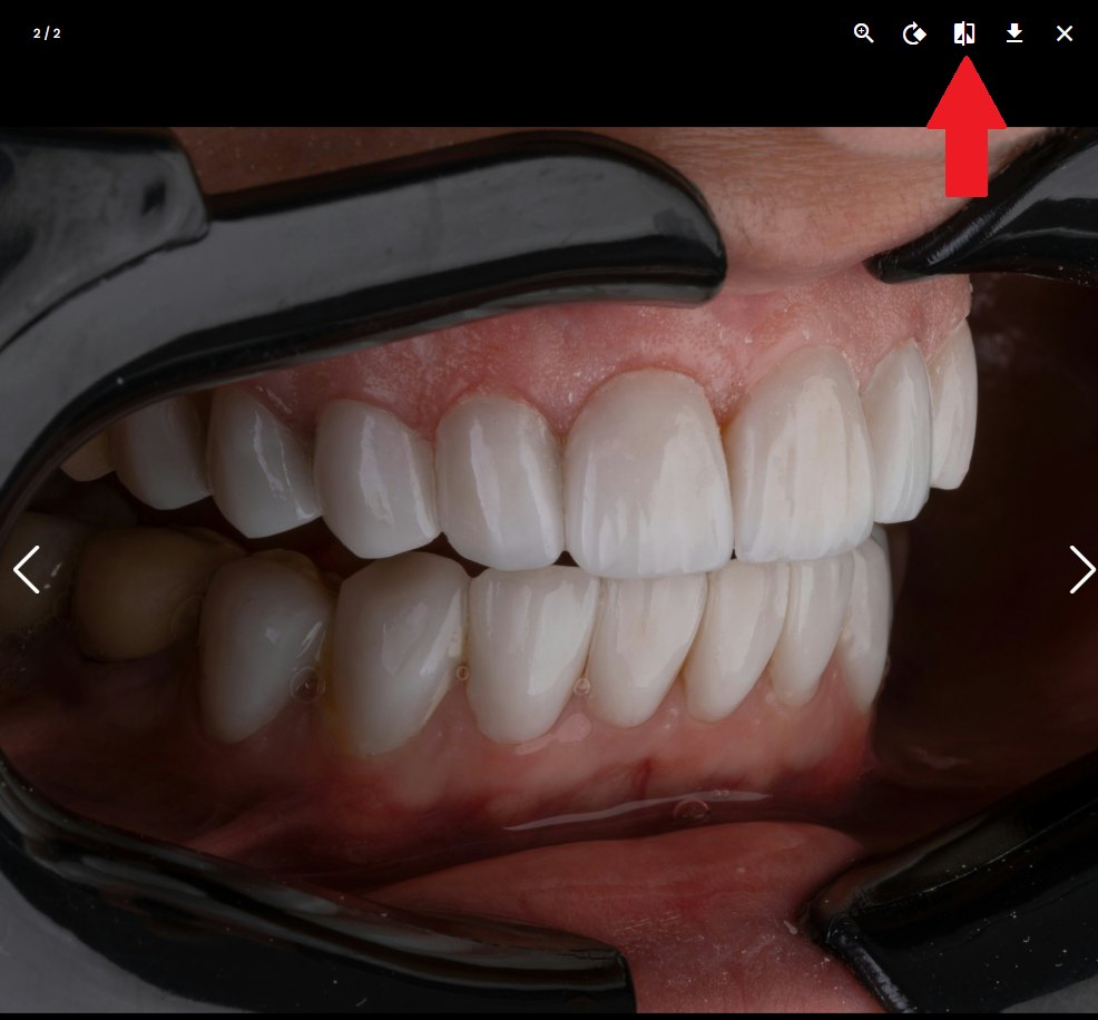 Bilder Spiegeln Ganz Einfach In Der Condent Dental Labor Software
