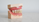 Condent Dentallabor Software Hat Eine Auftragsvorlage Mit Zahnschema